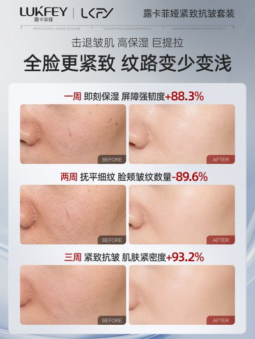 解析哪种护肤品抗皱好：淡纹抗皱推荐J9数字平台抗衰老的护肤品排行榜！(图2)